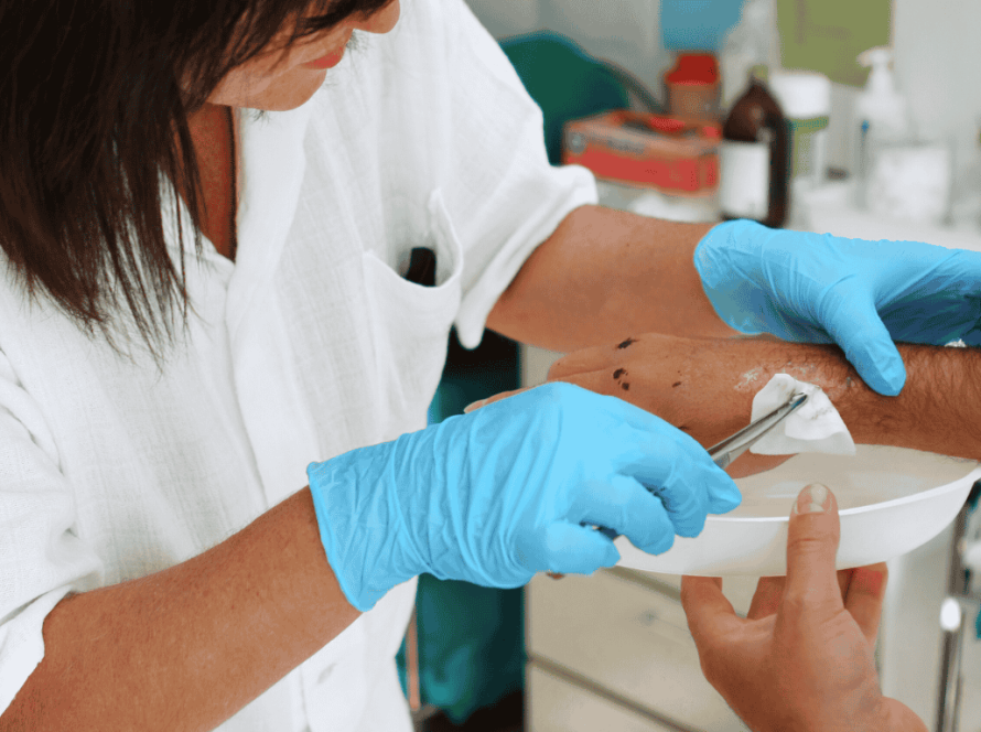 Wondverzorging aan huis